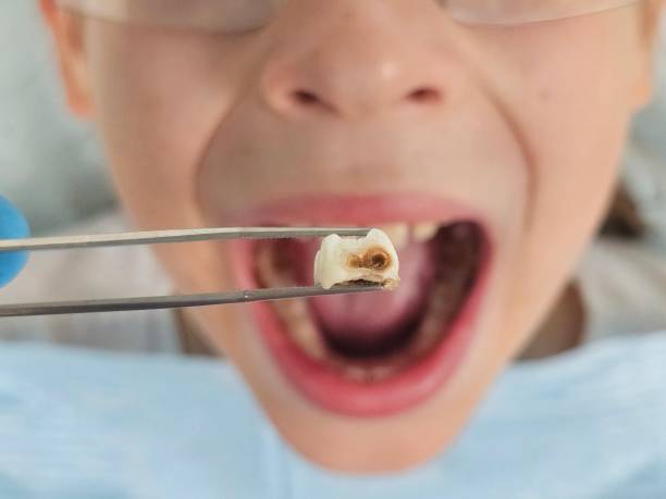 Best Walk-In Emergency Dental Services in Salmon, ID