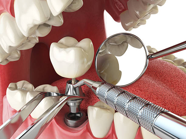Best Emergency Treatment for Jaw Pain or Injury in Salmon, ID